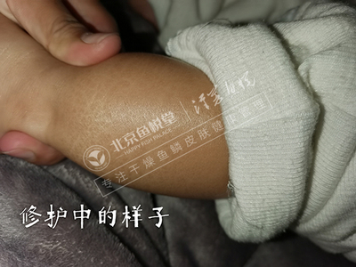 文章封面图